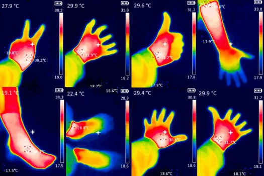 A thermographic image of a person's hand showing different temperatures in different colors, from blue indicating cold to red indicating hot, this may indicate inflammation of the joints. Red palm. Collage. What is a thermal camera.